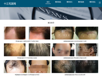 十三毛发网